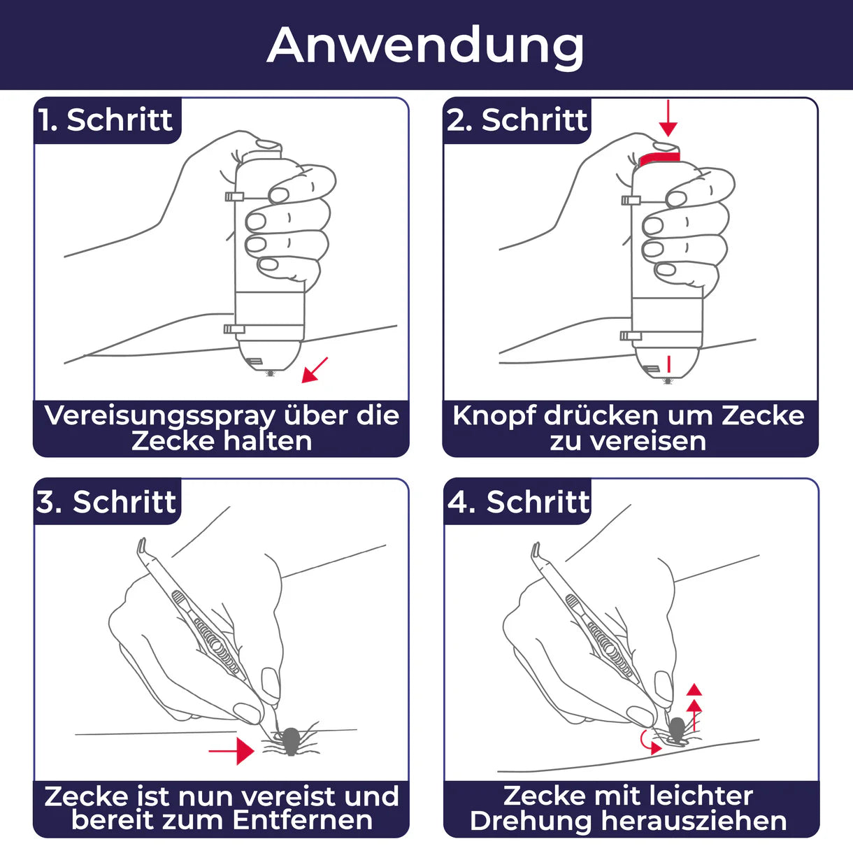 Die Abbildung zeigt die Anwendung von Kick the Tick zur sicheren Entfernung von Zecken. Zuerst wird das Vereisungsspray direkt über die Zecke gehalten und mit einem Knopfdruck aktiviert, sodass die Zecke vereist. Durch das Vereisen ist die Zecke betäubt und kann anschließend ohne Risiko entfernt werden. Mithilfe des speziellen Werkzeugs wird sie mit einer leichten Drehung herausgezogen. Dieses Verfahren sorgt dafür, dass die Zecke vollständig entfernt wird, ohne Rückstände zu hinterlassen, und bietet eine s